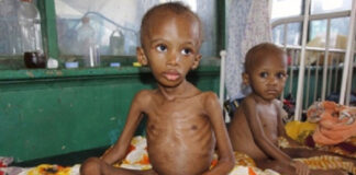 Malnutrition kills